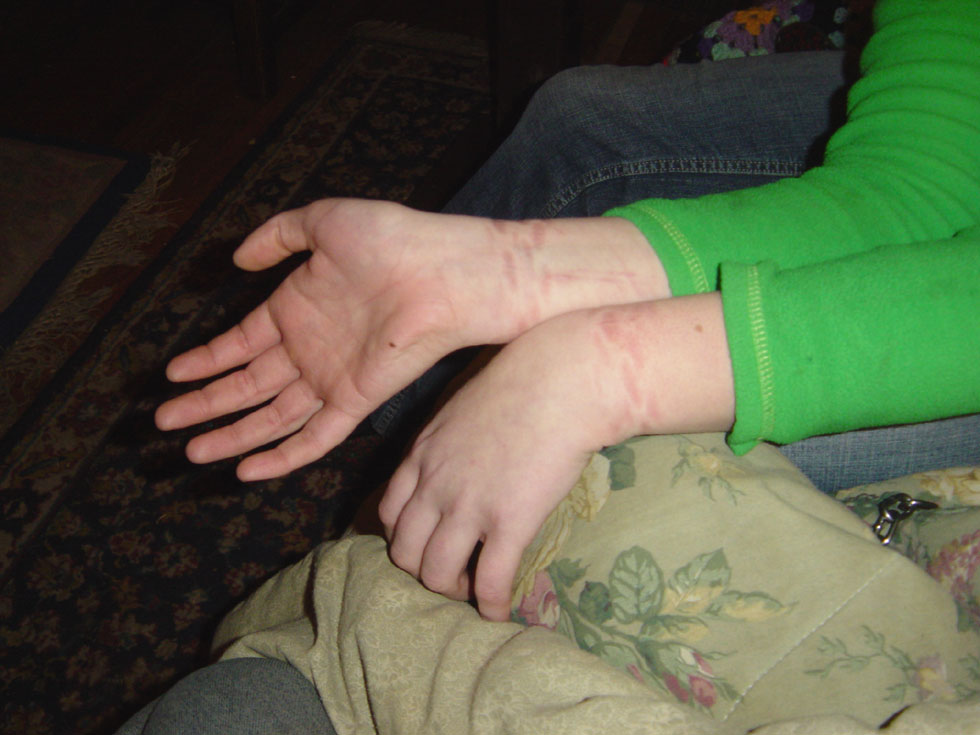 Indentations